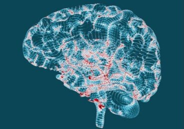 Die Huntington-Krankheit - Merkmale und Anzeichen