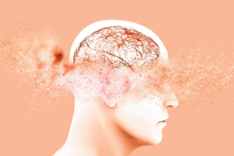 7 neue Entdeckungen über die Ursachen von Demenz