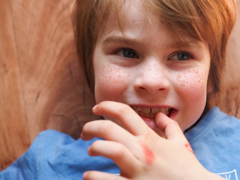 Stimming: Was ist selbsststimulierendes Verhalten?