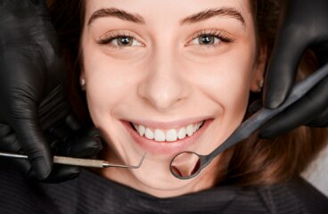 Veneers: Vorteile, Nachteile und die Frage nach der passenden Lösung